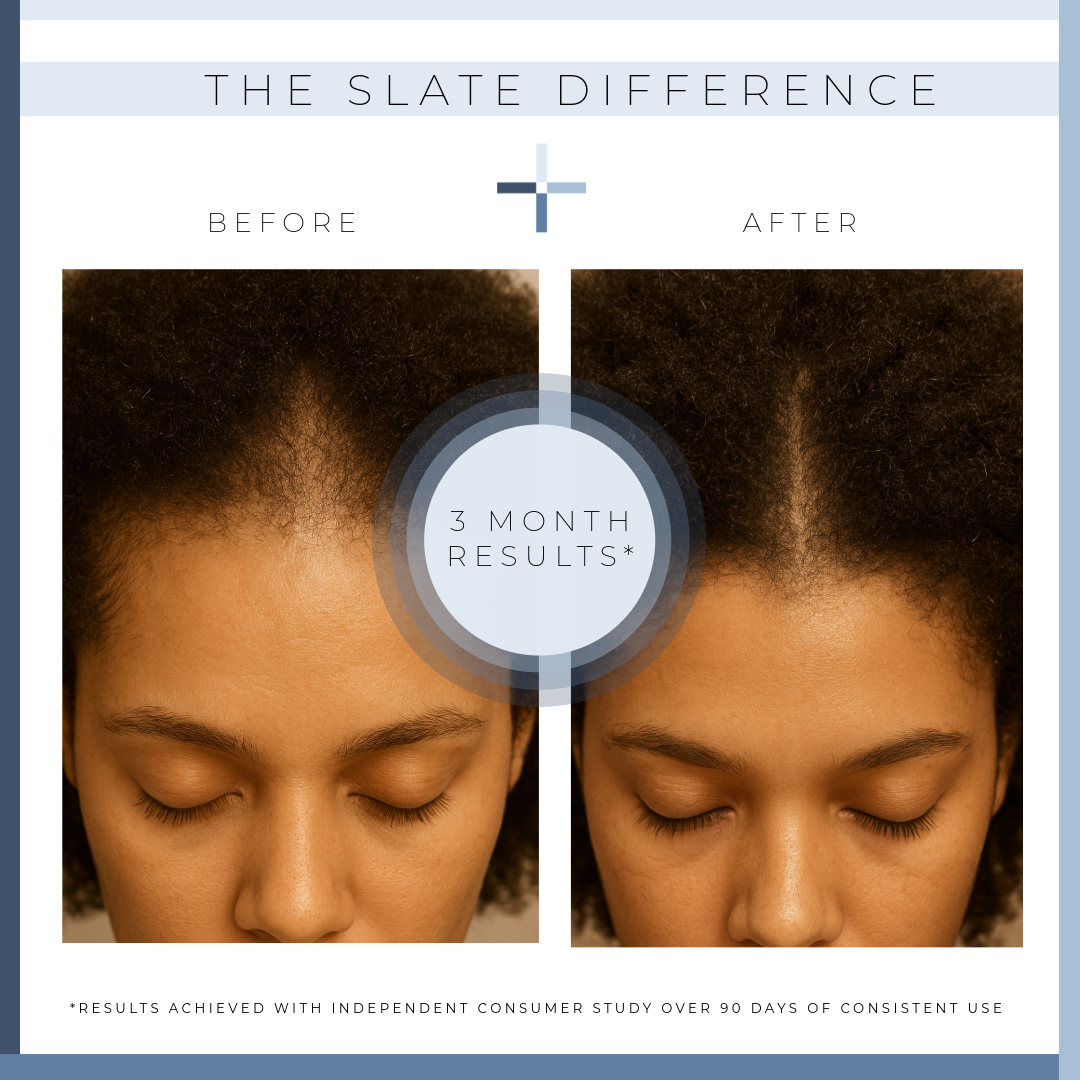 THE SPECTRUM REBALANCE SCALP SERUM