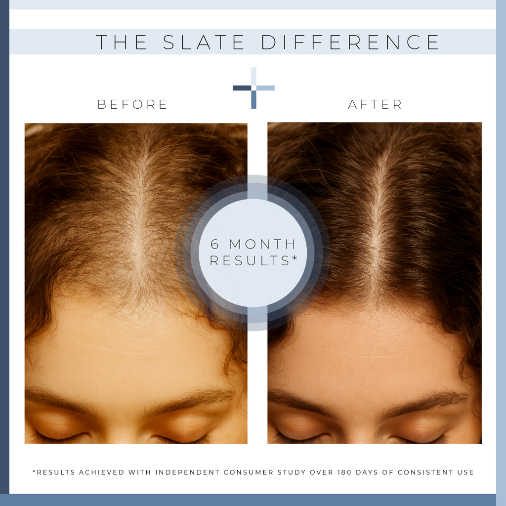THE SPECTRUM REBALANCE SCALP SERUM
